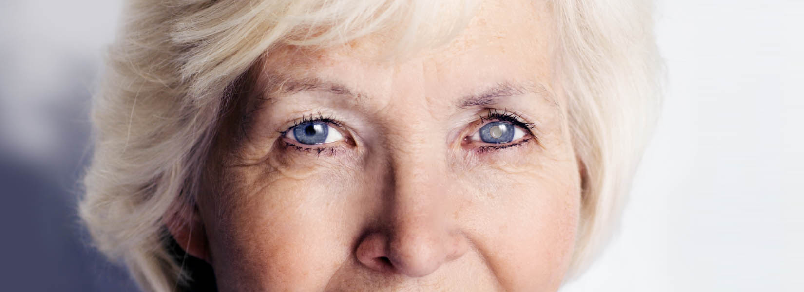 Cataract Surgery in Cottage Grove
